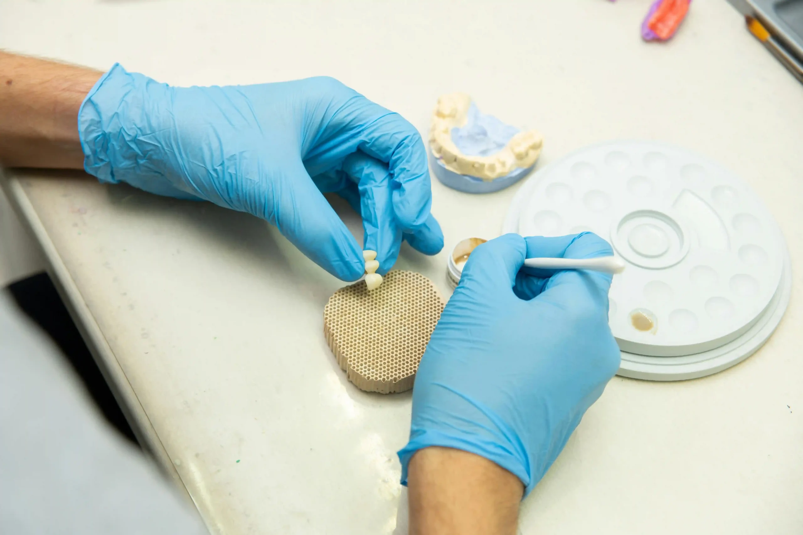 Elaboració d’una restauració al laboratori