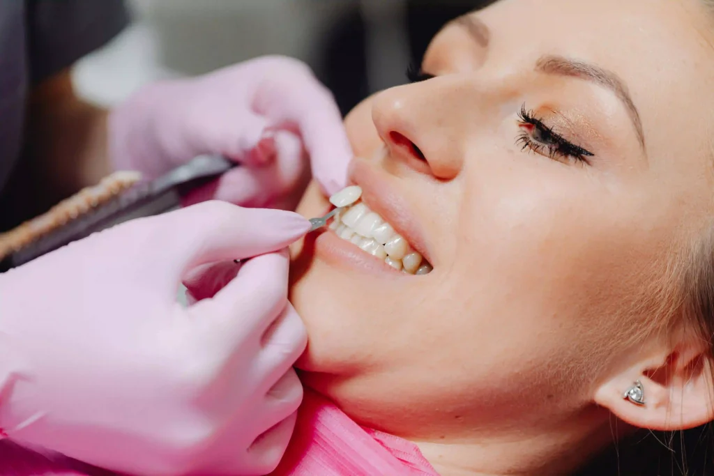 Estética dental