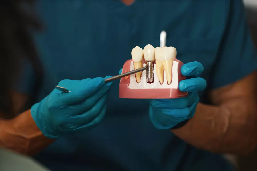 Explicación de un implante dental utilizando un modelo de dientes y encías