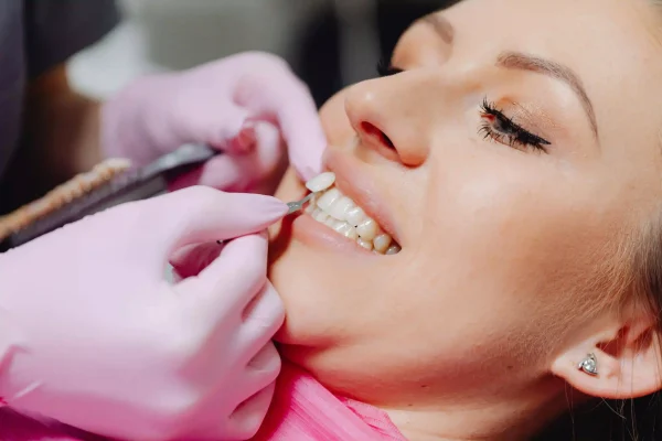 estetica dental